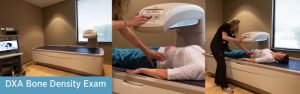 DXA Bone Density Exam