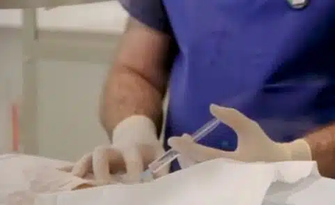 Back Pain: Before and After Steroid Injections