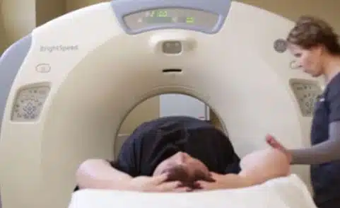 Should You Be Screened For Lung Cancer?