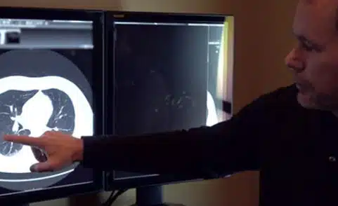 How are an MRI and a CT (or CAT Scan) Different?