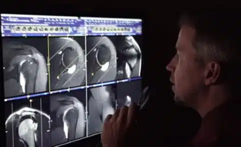 Dr. Keith Baynes looking at Arthrogram results